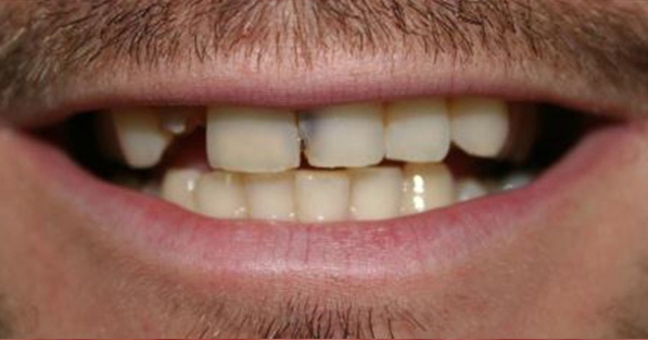Cosmetic Dentistry1