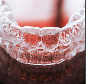 Clear Aligners