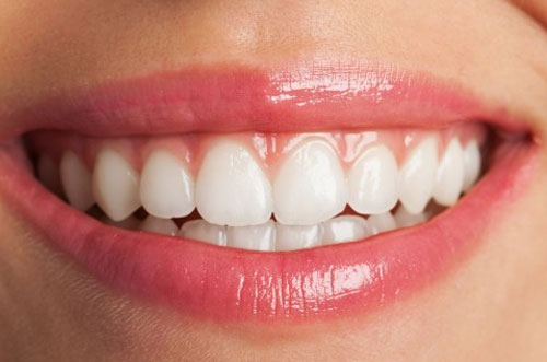Smile Redesigning, restoration by Cosmetic Dentistry