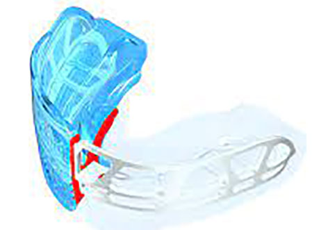 Functional Dental Appliances
