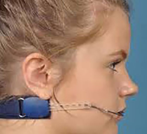 Chin Up for Jaw Alignment